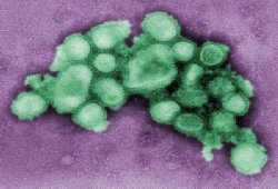 Mexico struggling to find source of killer flu